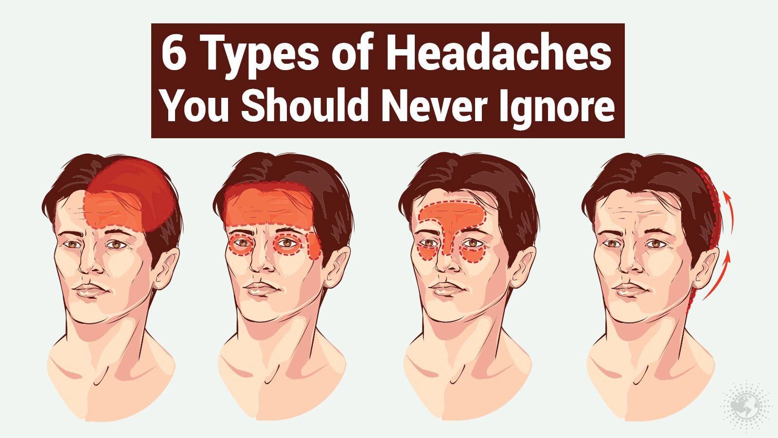 6 Types of Headaches You Should Never Ignore