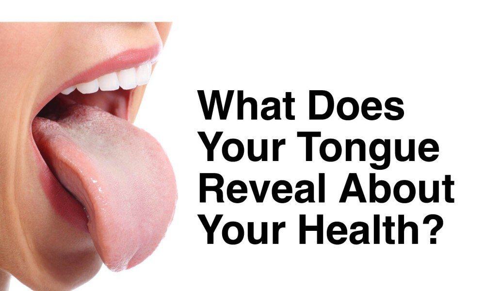 What Does Your Tongue Reveal About Your Health?