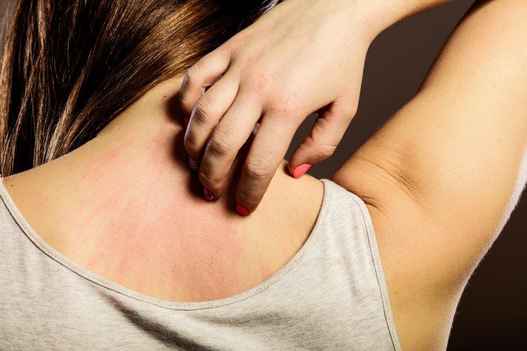skin allergy
