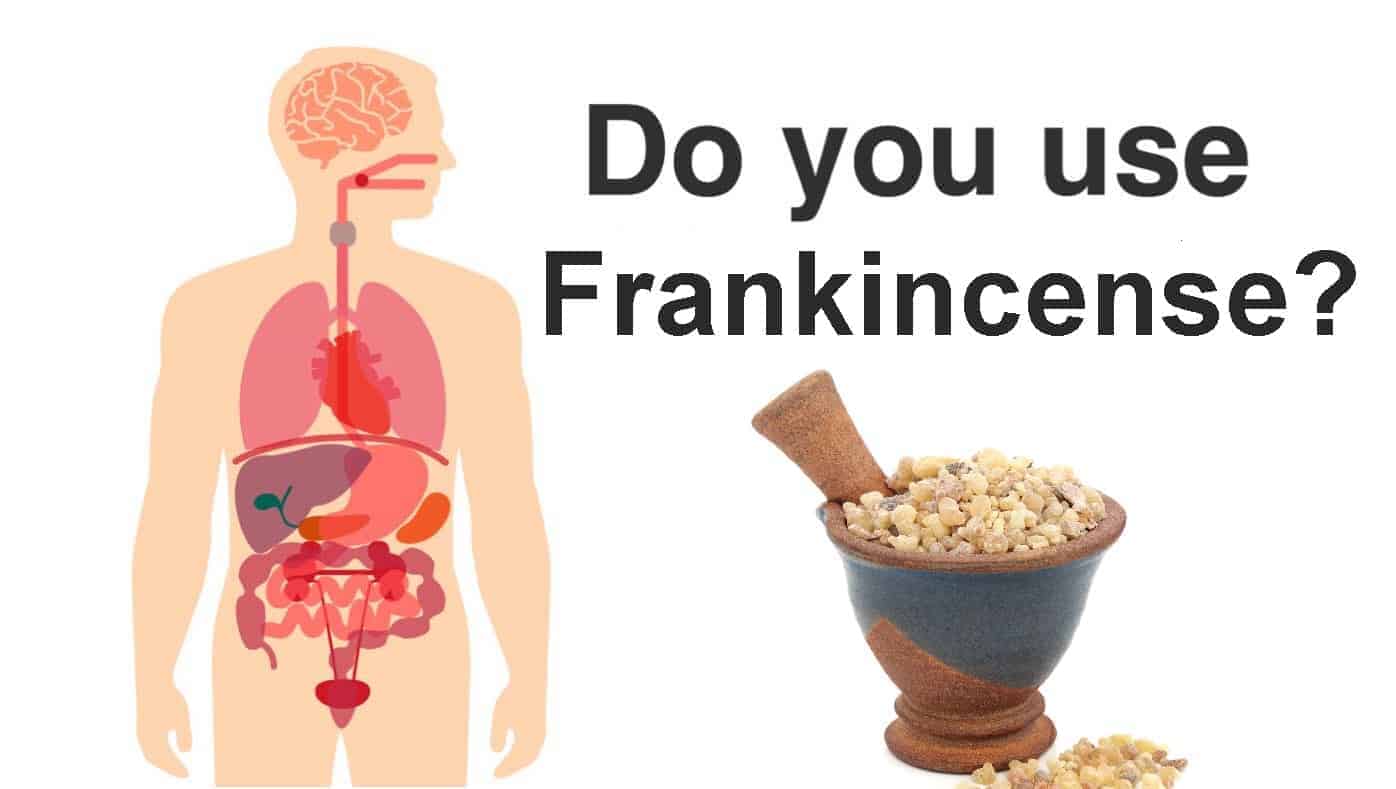 frankincense oil