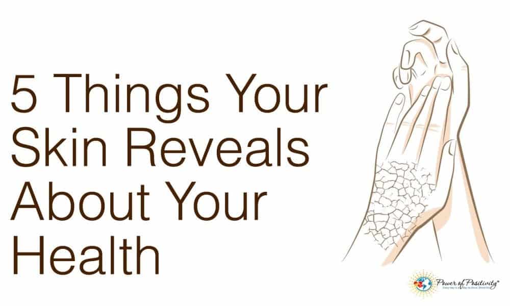 5 Things Your Skin Reveals About Your Health