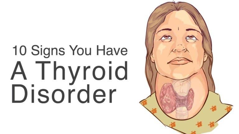thyroid disorder