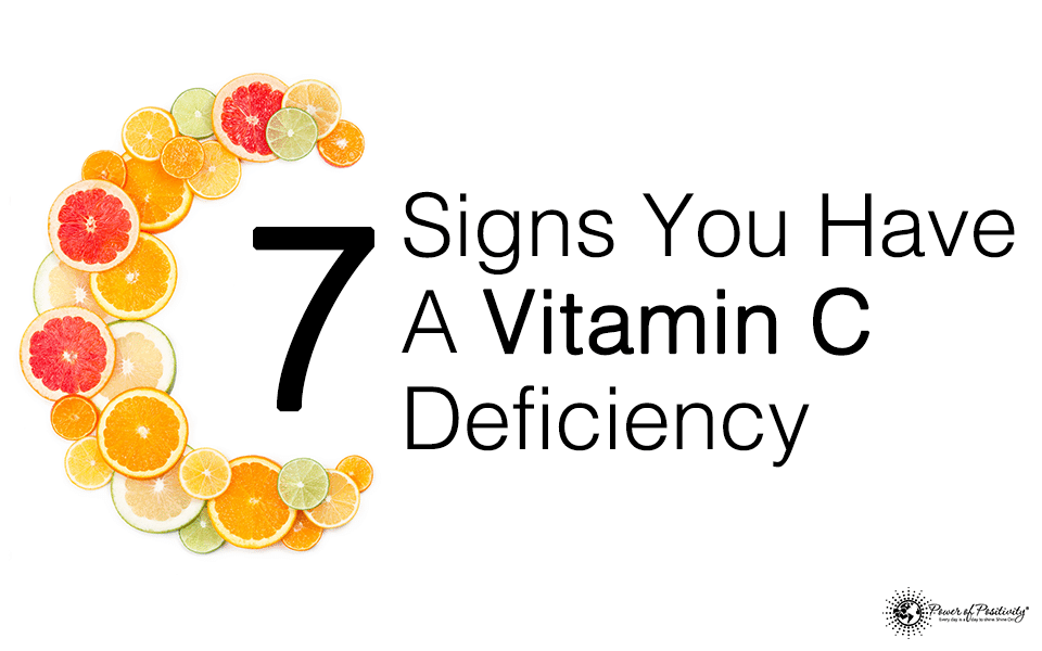 7 Signs You Have A Vitamin C Deficiency