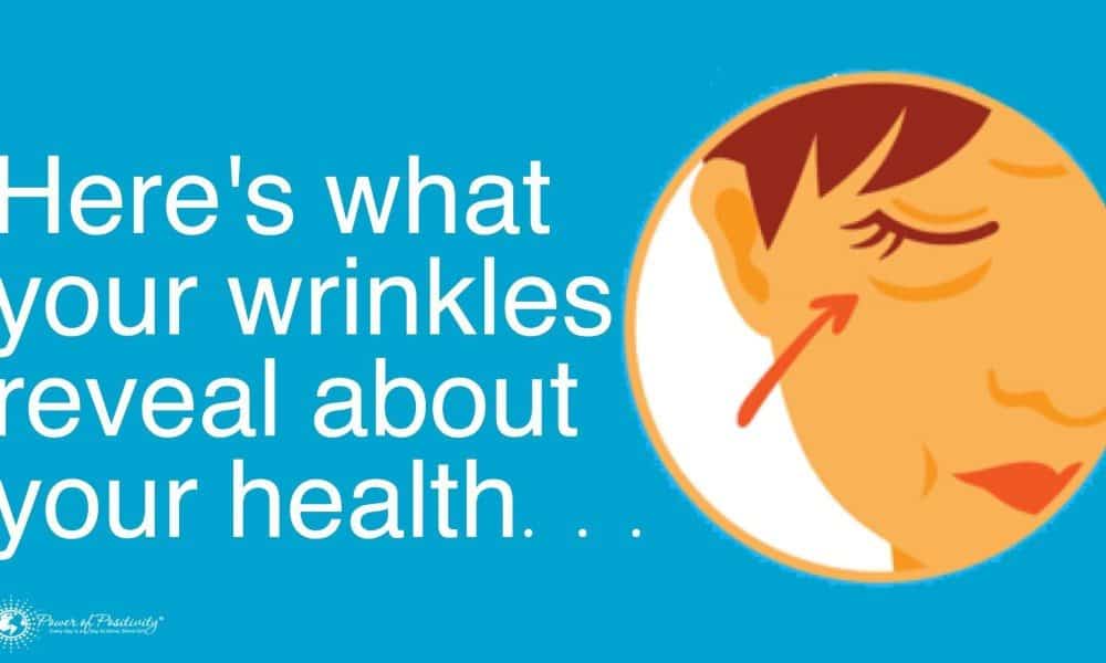What Do Your Wrinkles Reveal About Your Health?