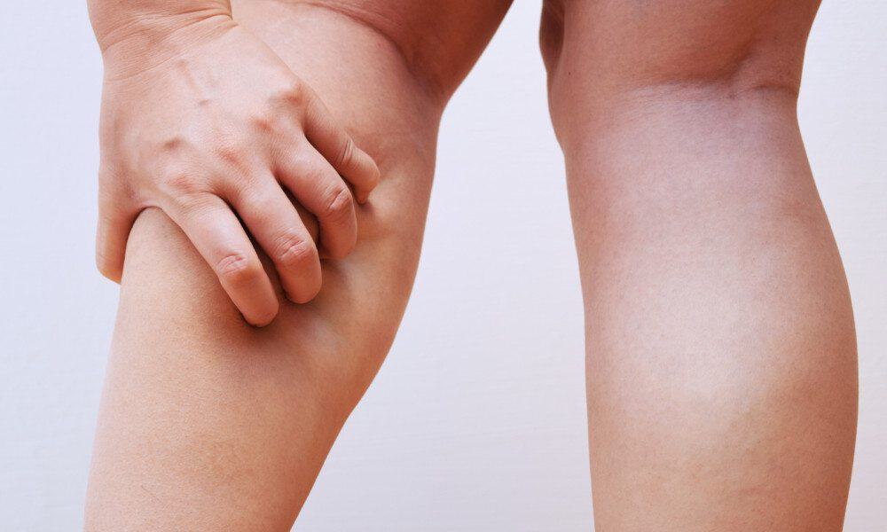 Scientists Explain 4 Things That Cause Leg Cramps (And How to Fix It)