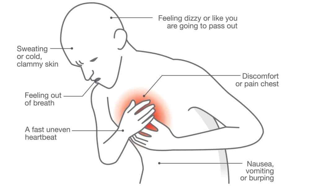 Know When It’s A Cardiac Arrest + 8 Symptoms And Tips To Recovery