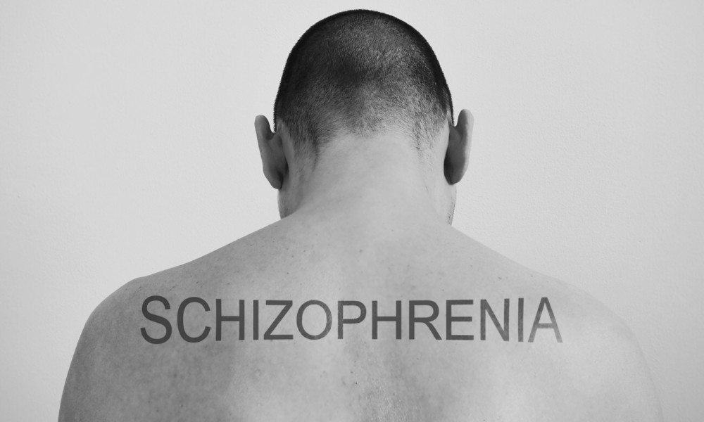 Schizophrenia Found to Actually Be These 8 Genetic Disorders