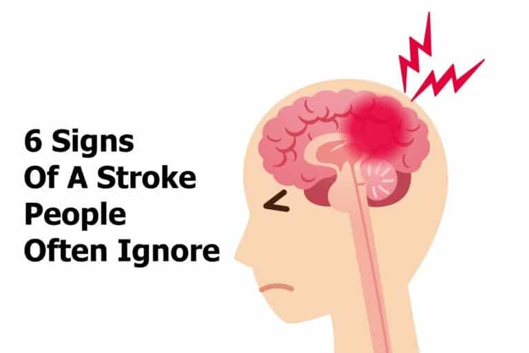 stroke