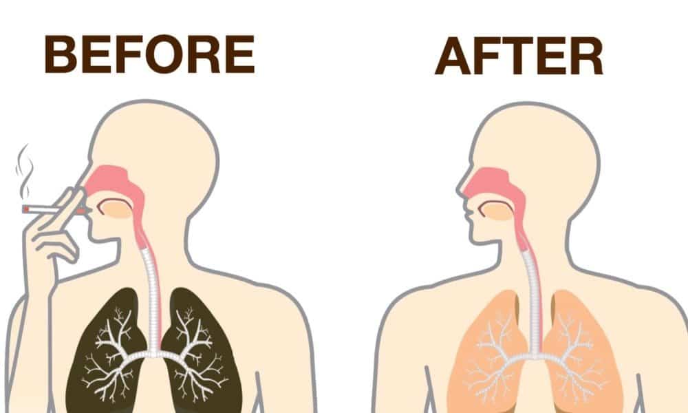 How To Naturally Detox Nicotine From Your Body