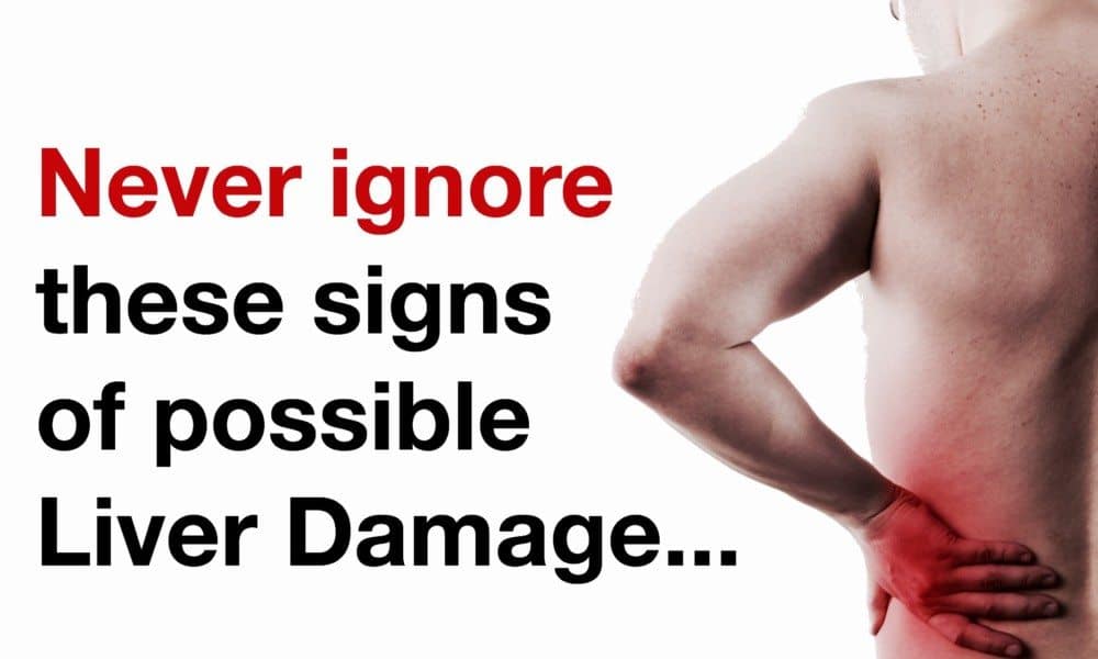 7 Signs Of Liver Damage