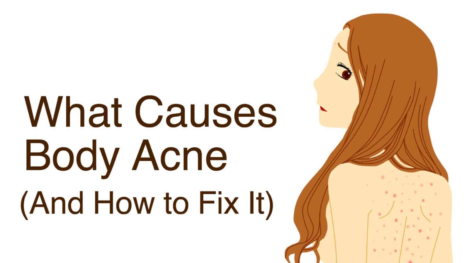 What Causes Body Acne (And How to Fix It)