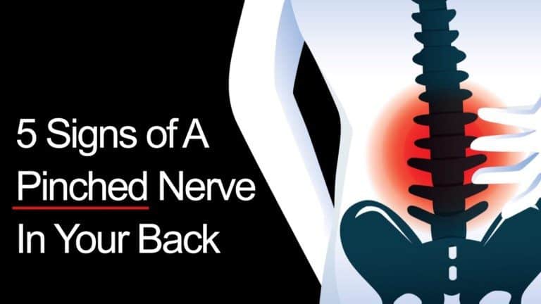 pinched nerve