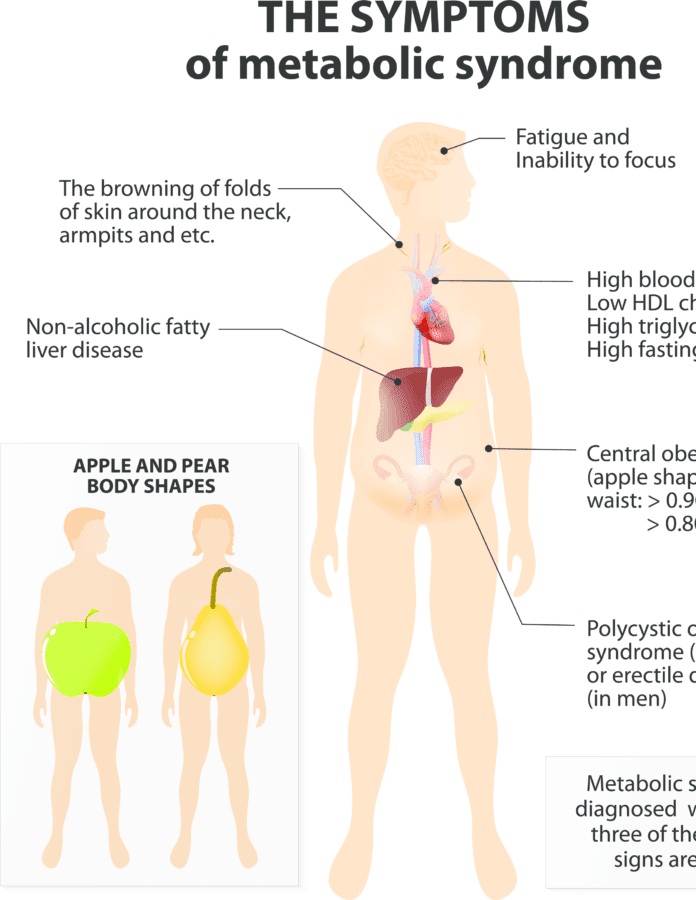 metabolic syndrome