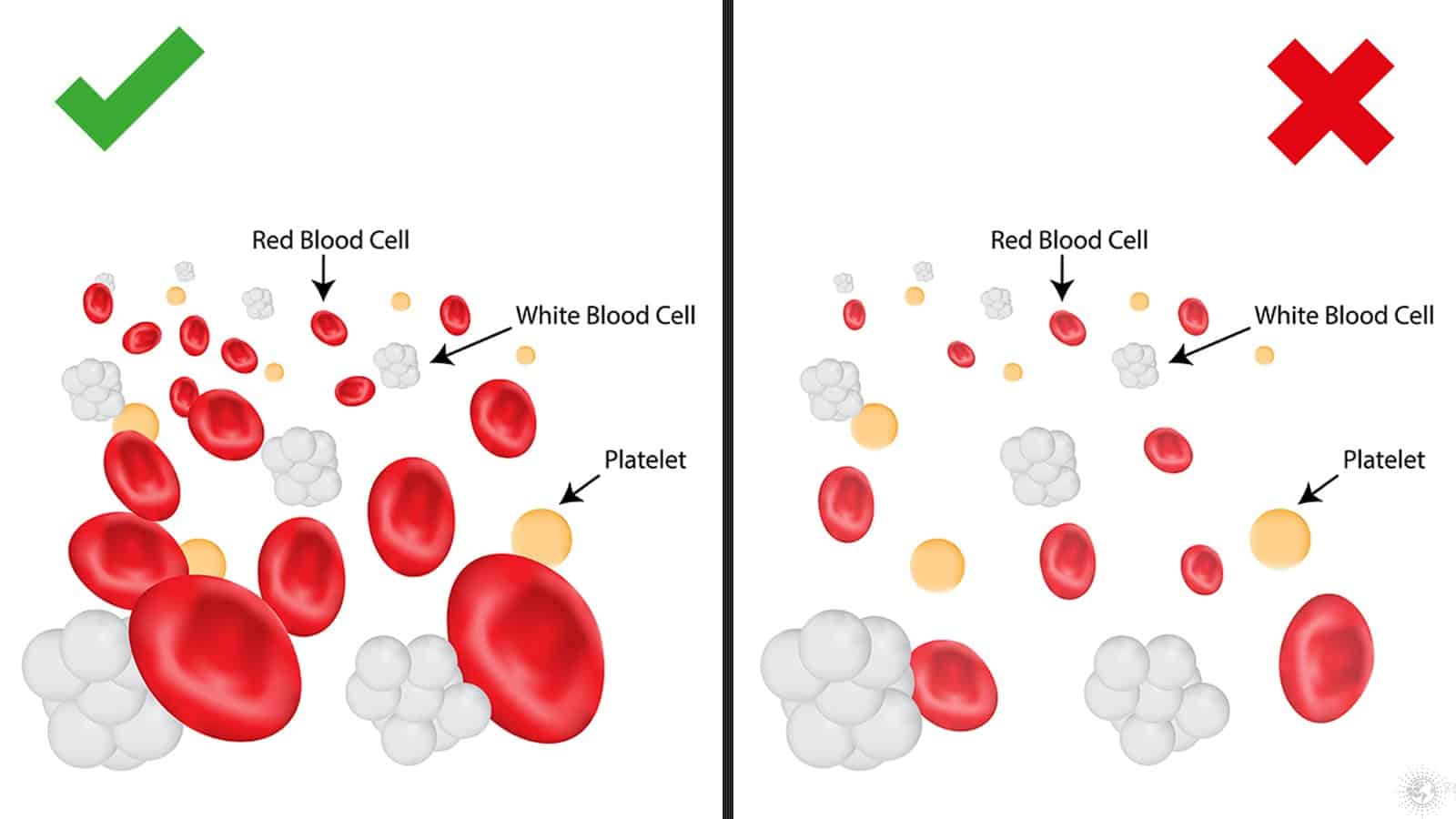 5 Signs You Have A Low Red Blood Cell Count
