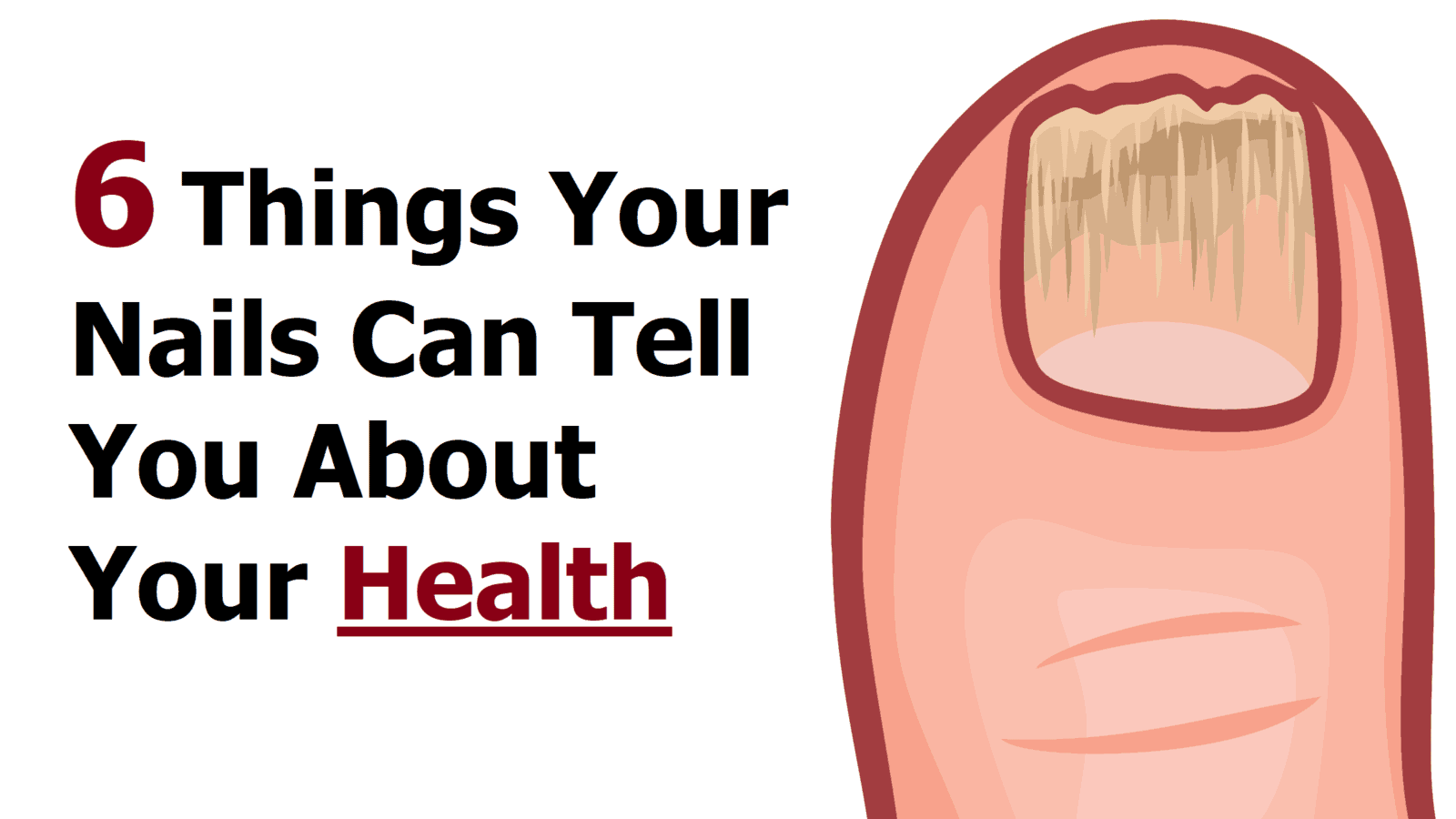 6 Things Your Nails Can Tell You About Your Health