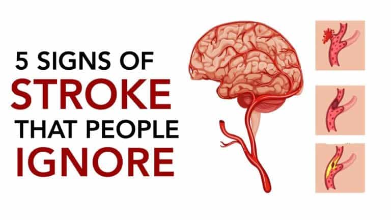 Avoid stroke