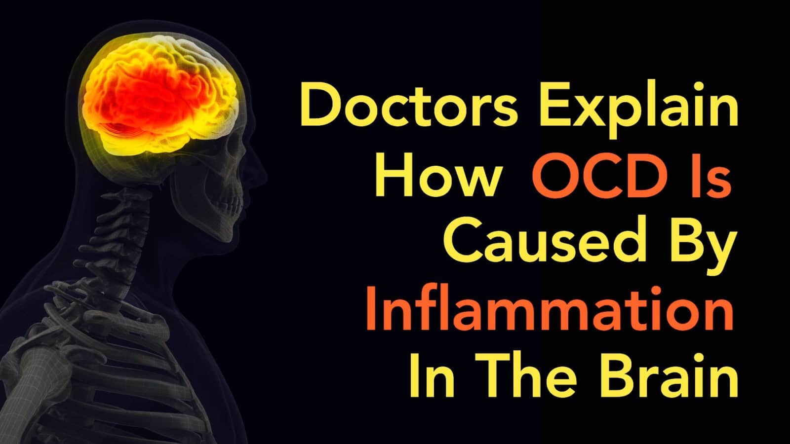 Doctors Explain How OCD Is Caused By Inflammation In The Brain