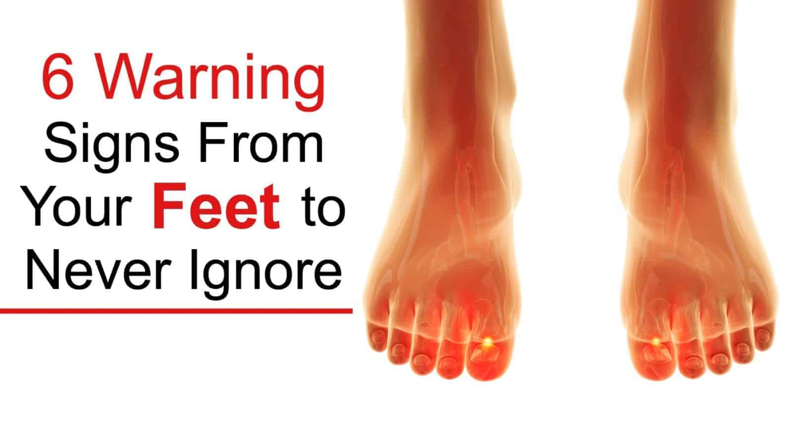 6 Health Warning Signs From Your Feet to Never Ignore