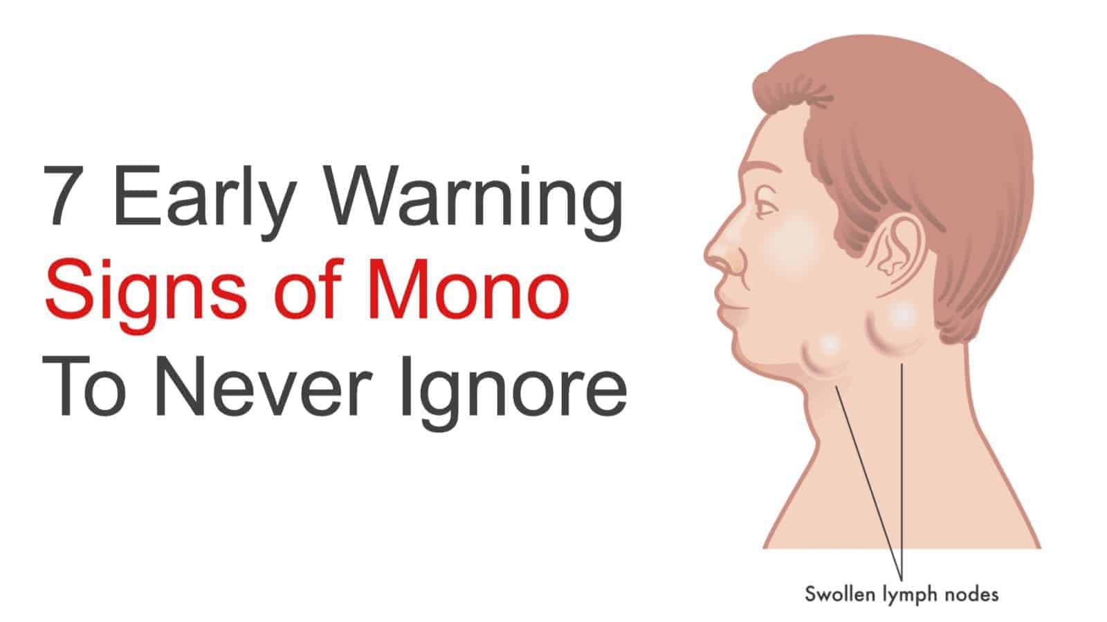 7 Early Warning Signs of Mono to Never Ignore