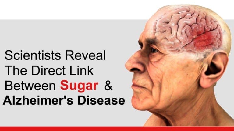 alzheimers