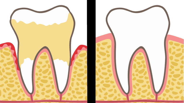 teeth