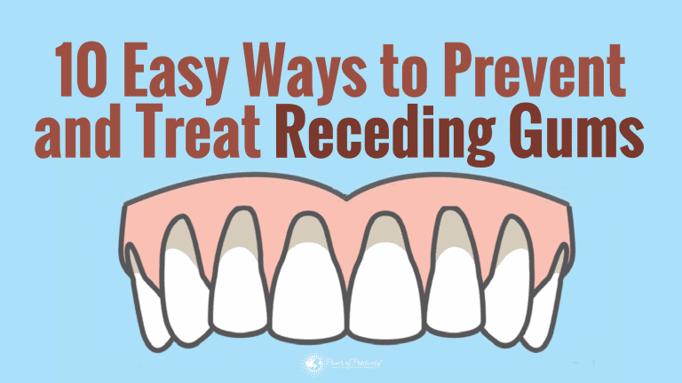 gums receding