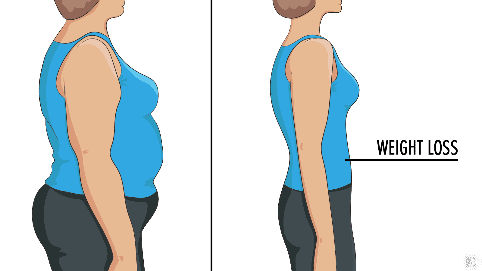 Health Expert Explains 6 Ways To Lose Weight If You Have PCOS