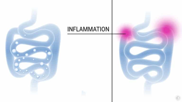 inflammation foods