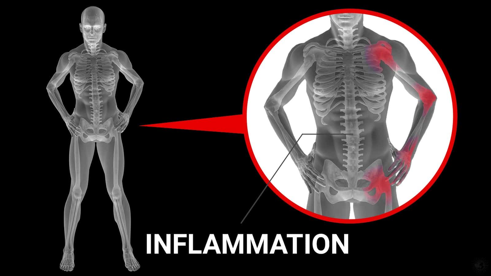Experts Reveal 10 Foods That Fight Inflammation
