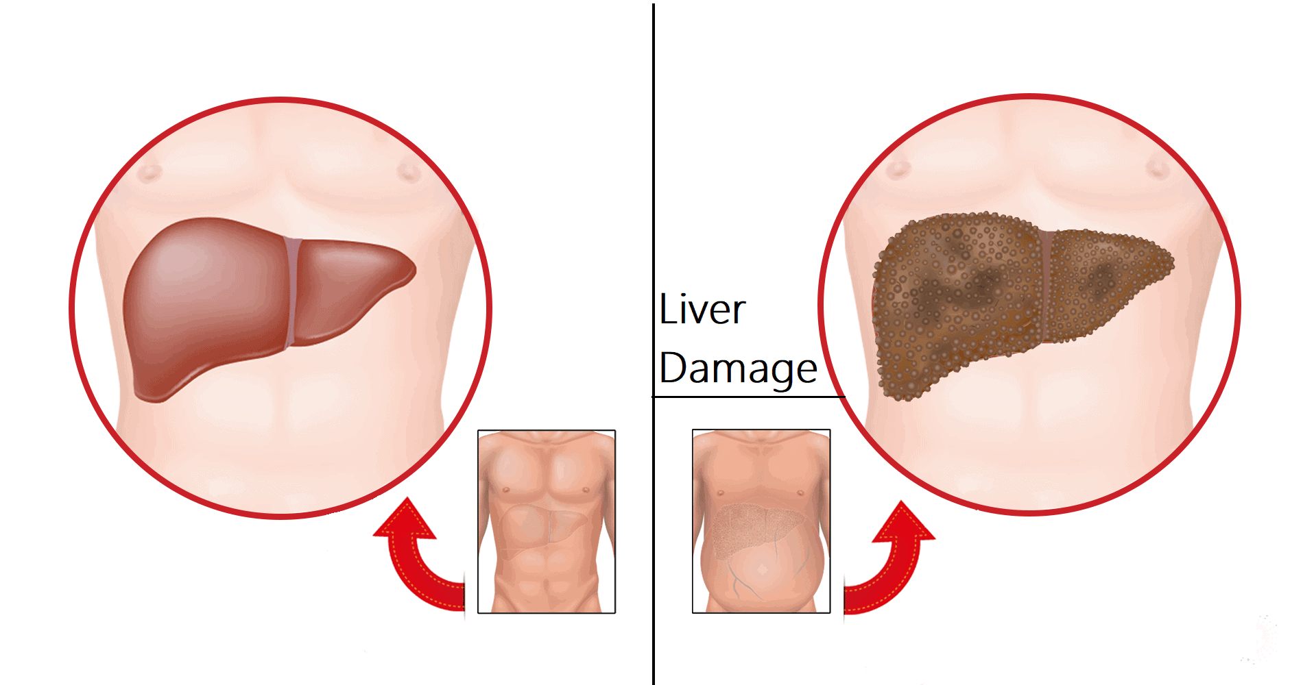 7 Early Warnings of Liver Damage to Never Ignore