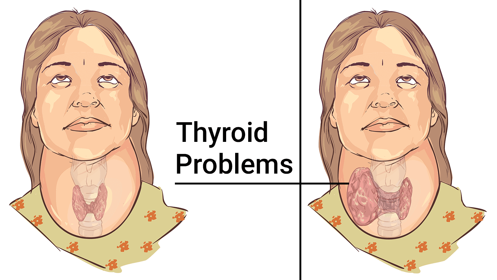 This 60 Second Test Will Tell You If Your Thyroid Is Working Properly