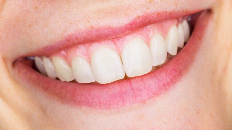 smile personality