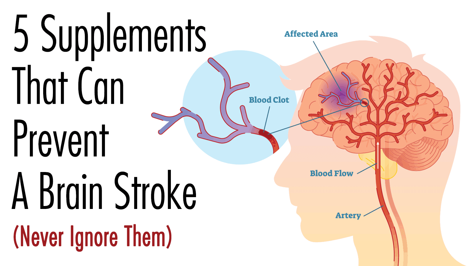 5 Supplements That Can Help Prevent a Brain Stroke