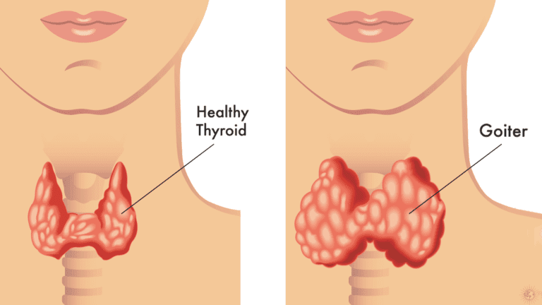 thyroid