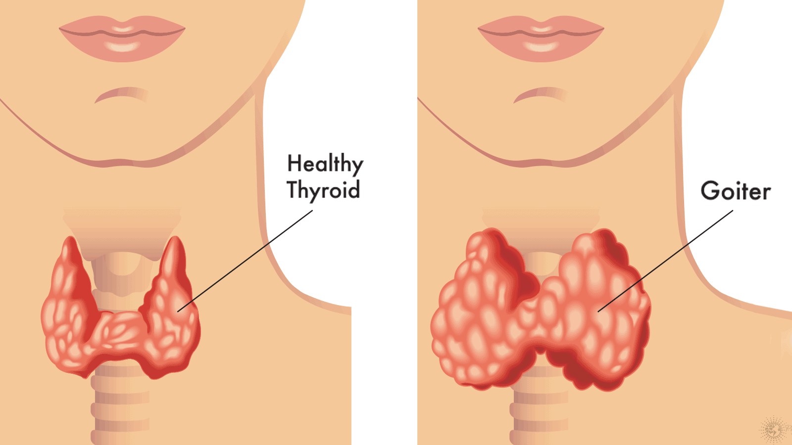 5 Things You Need To Know About Your Thyroid
