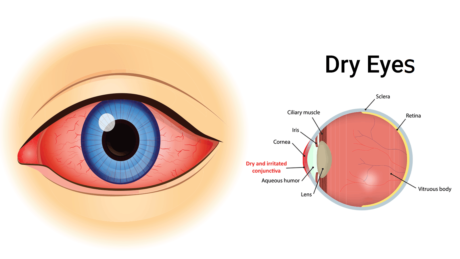 4 Easy Ways to Heal Dry Eyes Naturally