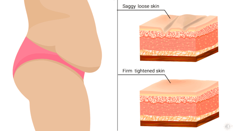tighten sagging skin