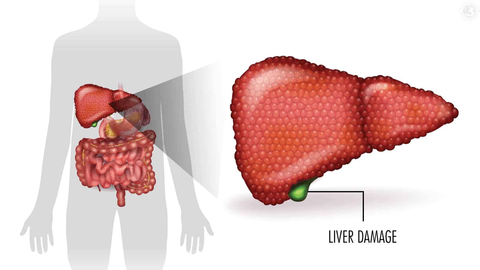 Scientists Explain 9 Ways to Heal Liver Damage