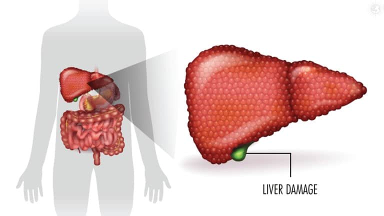 liver damage