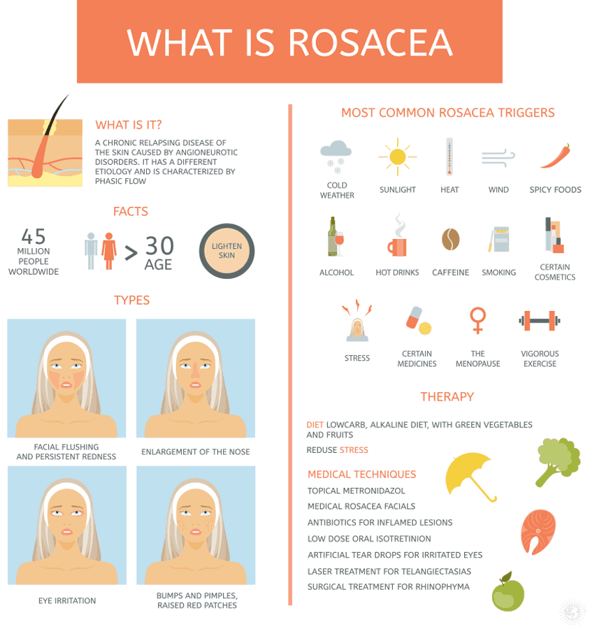 rosacea