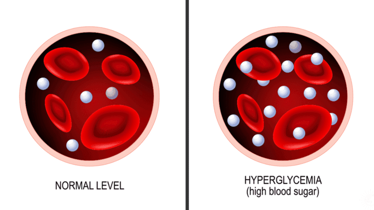 how to control blood sugar naturally