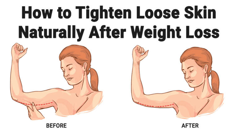 loose skin