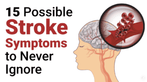 signs of a stroke