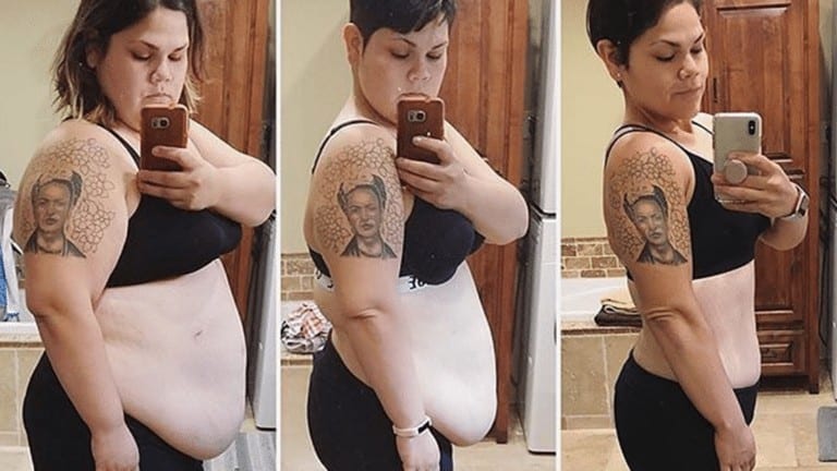 weight loss