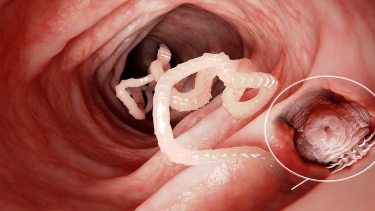 tapeworm