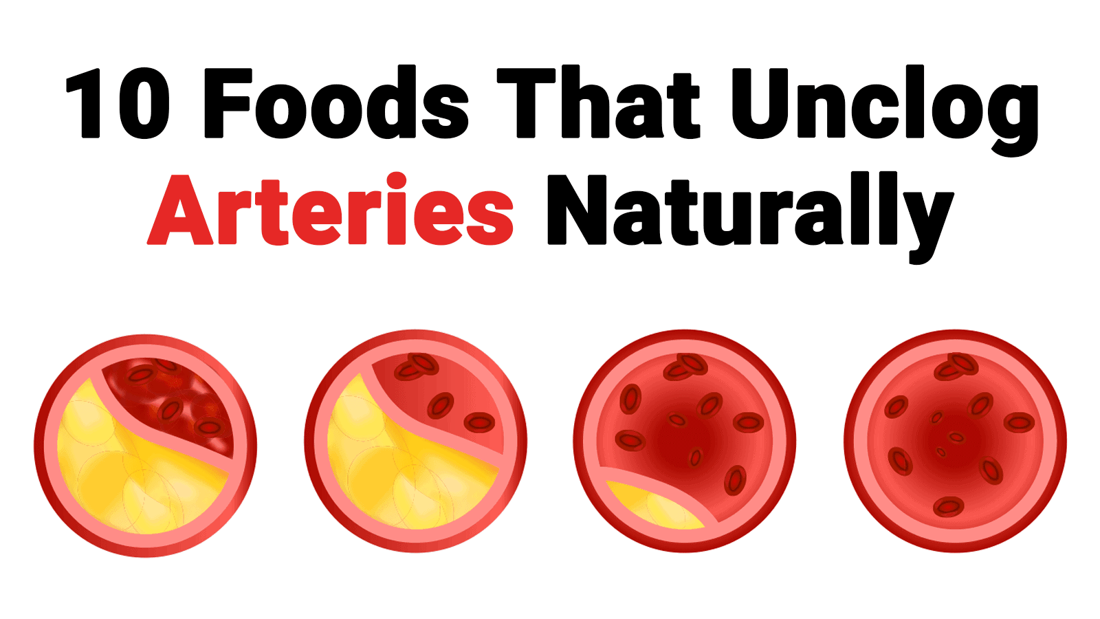 10 Foods That Unclog Arteries Naturally