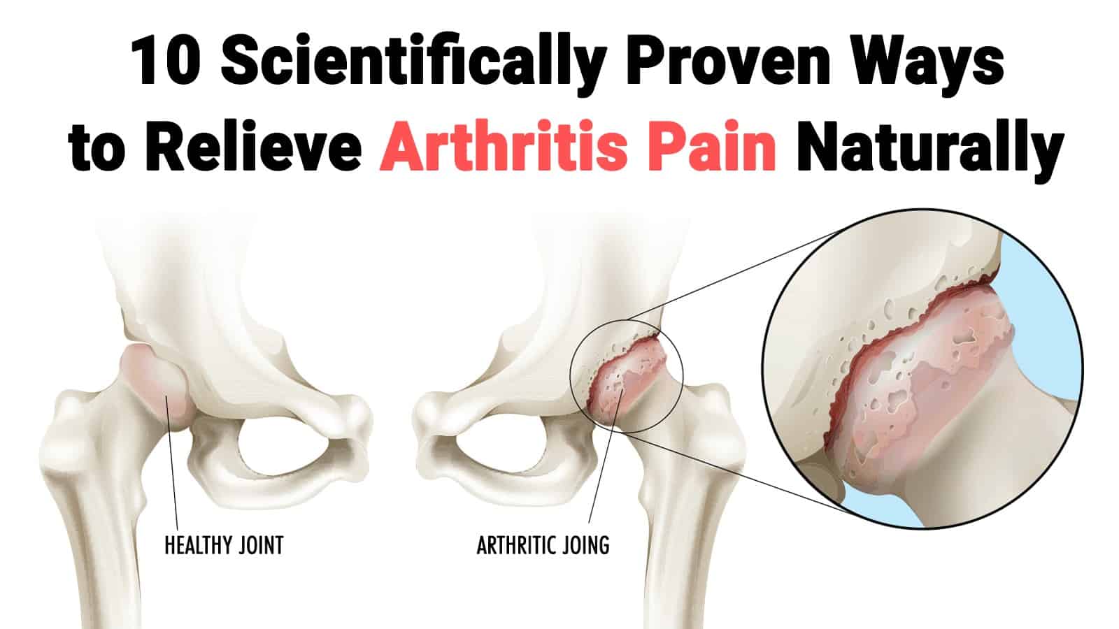 10 Scientifically Proven Ways to Relieve Arthritis Pain Naturally