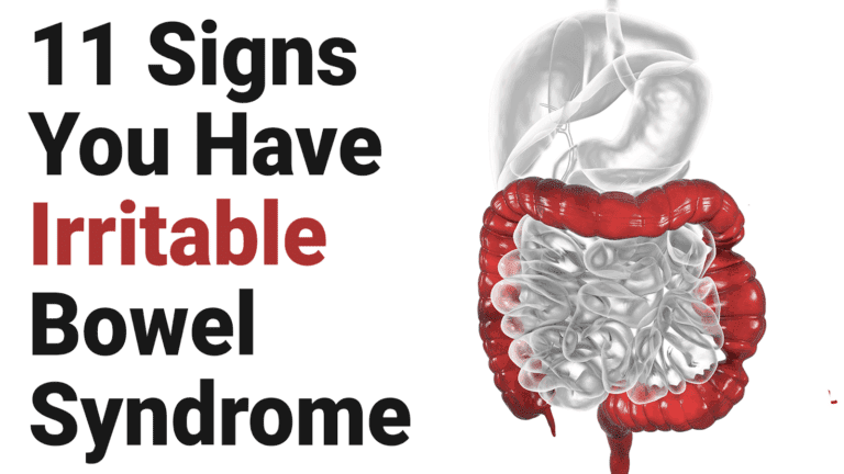 irritable bowel syndrome