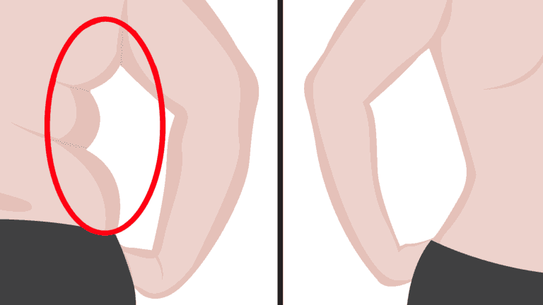 back fat
