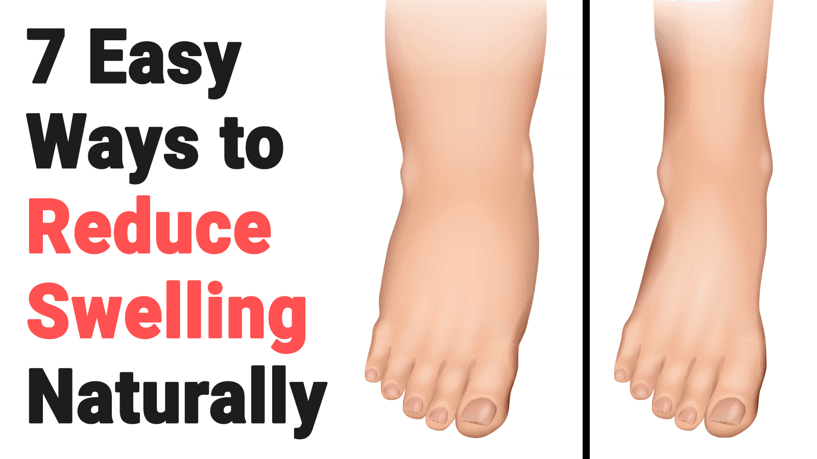 7 Easy Ways to Reduce Swelling Naturally